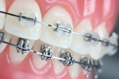 Advanced-Ortho-Session-11