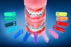 orthodontic-faq