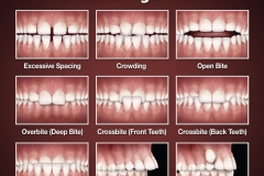 orthodontic-problems